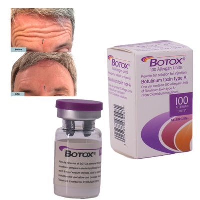 New Botox Allergan Aesthetics 100IU Toxin Injection Smooth Wrinkles Reduction