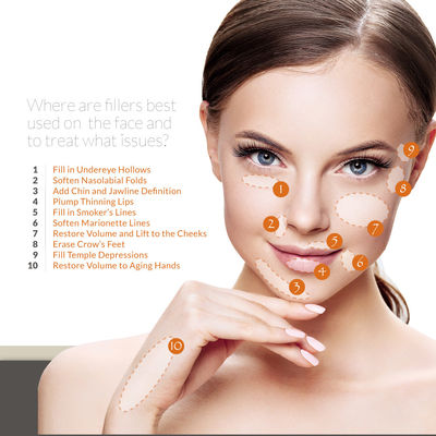 Van de de Vullerinjectie van het Skinject verwijdert Hyaluronic Zure Gel het Voorhoofdrimpel