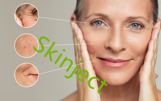 Injecties van de de Vullerlip van Skinject de Fijne Ha Huid