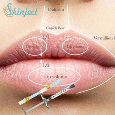 De volledige van de Vuller Hyaluronic Zure Ha van de Lippenwang Injecteerbare Huidvuller 1ml 2ml 5ml