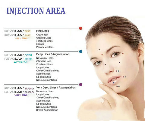 Revolax Hyaluronic Zure Gezichtsvullers voor Gezichtsuitbreiding