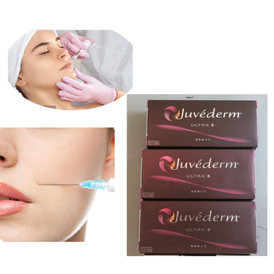 Injectie Juvederm 2x1ml ultra 3 Lippen Huidvuller 24mg/Ml