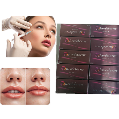 De Vuller Hyaluronic Zure Huidvuller Juvederm van het lippengel ultra 3 ultra 4