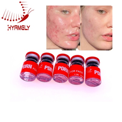3 van de de Injectiehuid de Hulppdrn van ml Microneedle Reparatie van de het Serumhuid