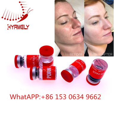 Het anti Verouderen Meso Seruminjectie met Hyaluron Pen Dermal Filler
