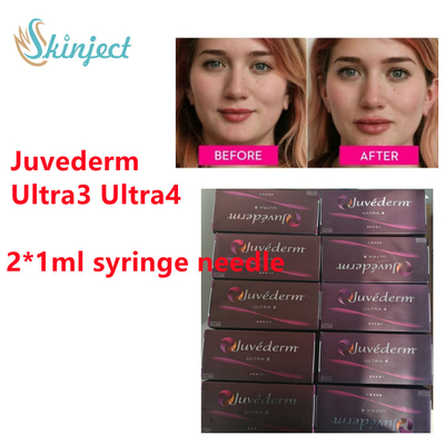 De Lippenvuller van Juvederm van de Juvederm Hyaluronic Zure Huidvuller met  2x1ml Ultra3 Ultra4
