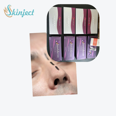 Hyaluronic Zure Huidvuller Juvederm Ultra3 voor Lippen