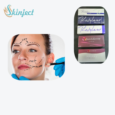 Injecteerbare Huidvuller voor Scheurtroggen Before And After Juvederm-Glimlachlijn