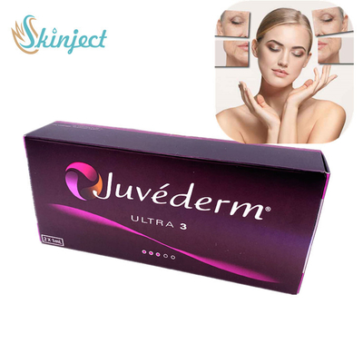 Juvederm huid de vullerinjectie van ultra 3 hyaluronic zure injectie gezichtsvullers