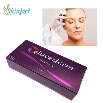 Juvederm huid de vullerinjectie van ultra 3 hyaluronic zure injectie gezichtsvullers
