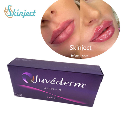 De Vuller Hyaluronic Zure Huidvuller van Juvederm2*1ml Lippen met Lido Ultra4