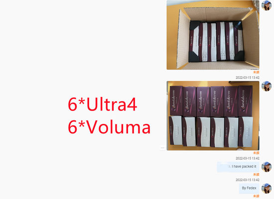 Lippengezicht die Hyaluronic Zure Huidvuller Juvederm Ultra4 Voluma gestalte geven