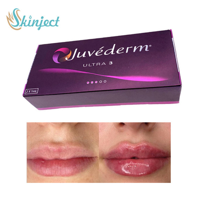 281ML Hyaluronic Zure Lippenvuller Juvederm Ultra3 Huid