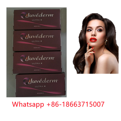 De Huidvuller van Ultra4voluma Juvederm voor Lip en Gezicht