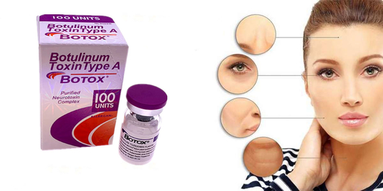 Het Type van de Allergan Botulinum Toxine A  Poedervorm