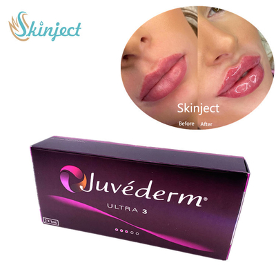 Juvedermultra3 2x1ml Hyaluronic Zure Gezichtsvullers Huid