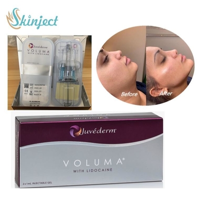 Huid de Vuller Hyaluronic Zuur van Juvedermvoluma voor Gezichtswang Chin Contour