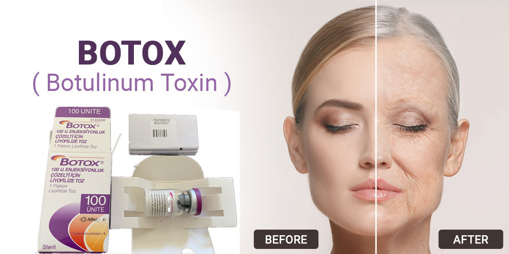 de Toxinetype van 100Units Allergan Botulinum A Injectie voor Gezichtsrimpelverwijdering