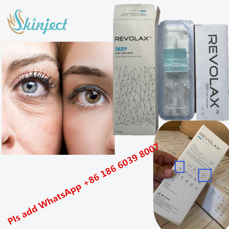 Het kruis verbond Huid de Vuller Dwarsaaneenschakeling Ha Hyaluronic Zure 24 Mg/ml van Vullerrevolax