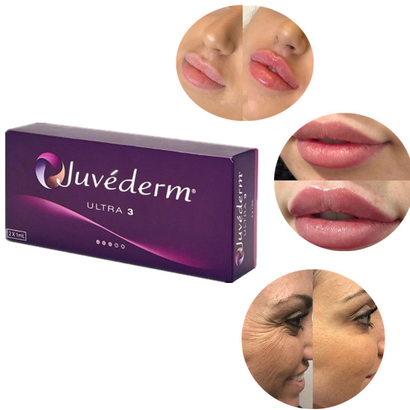 De brandkast Crosslinked Huid Hyaluronic Zure Vuller voor Alle Huidtypes