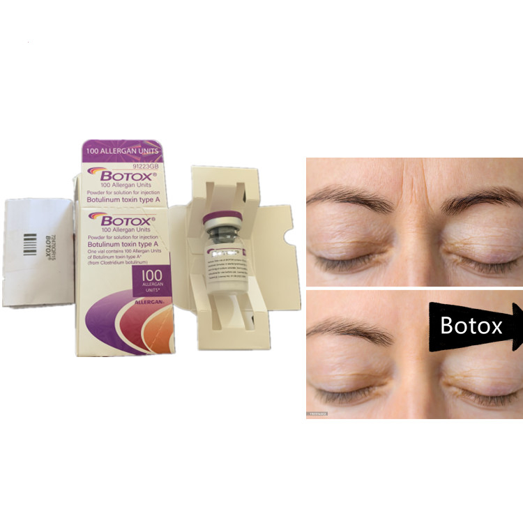 Allergan 100ui Botulinum Toxin Serum Anti-aging product voor gezichtsdysport
