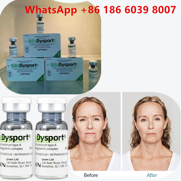 Botulinum Toxin Type A 100 Eenheden  Injectie Voor Gezichtsrimpels