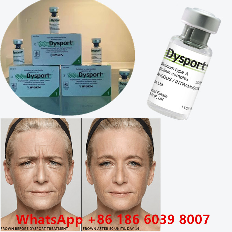 Botulinumtoxin 100 Eenheden BTX Injectie Type A Cosmetisch gebruik