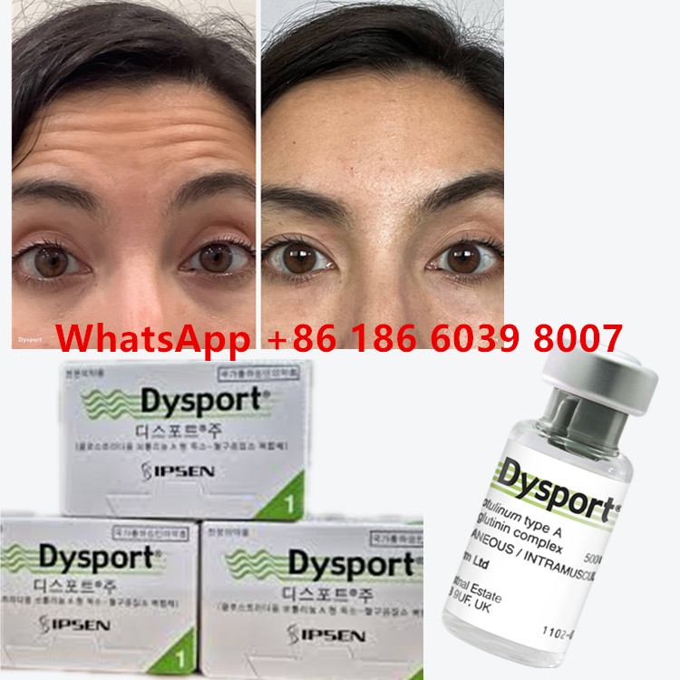 Botulinum Toxin Dysport Clostridium Botulinum Type A 500 eenheden/flacon Voor fronslijnen