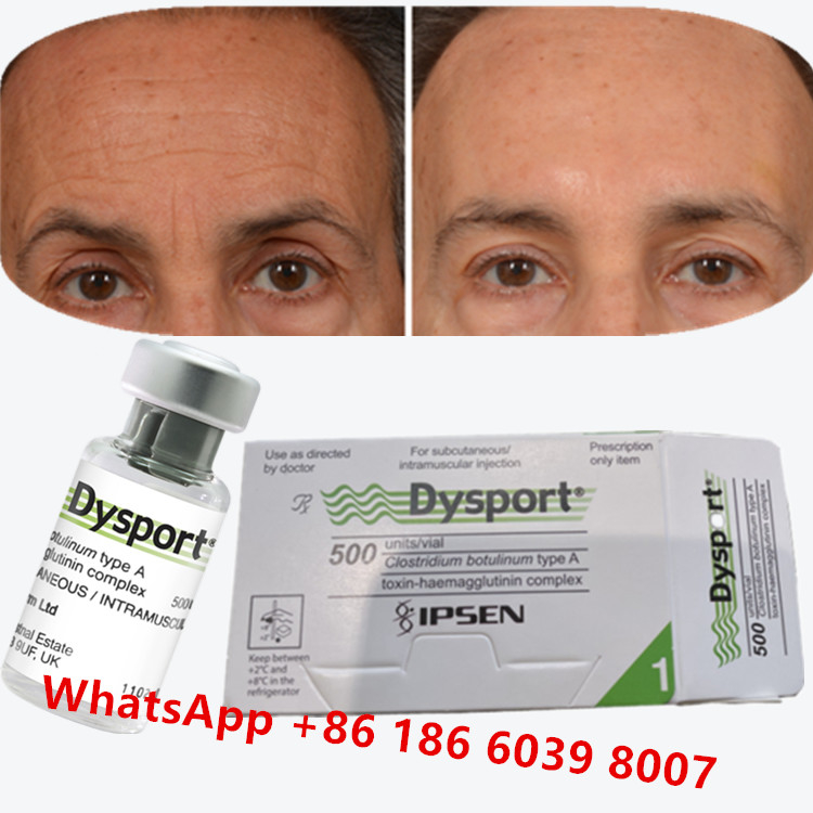 Botulinumtoxin Dysport Clostridium Botulinum type A Voor kraaienpootjes