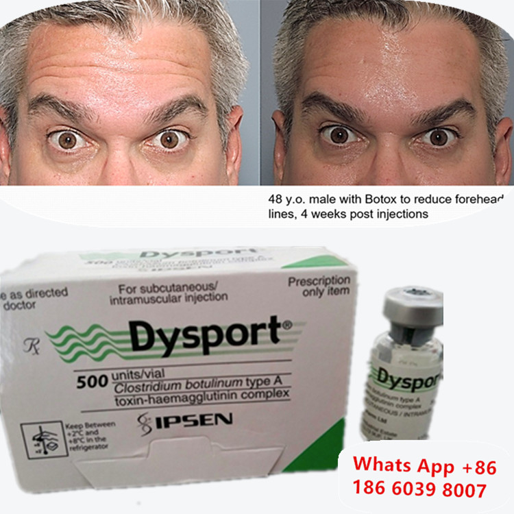 Botulinetoxine Dysport Botox Clostridium Botulinum Type A voor wenkbrauwlift