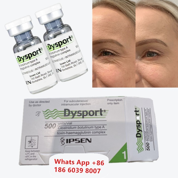 Dysport Botulinetoxine Type A voor Traangootrimpels