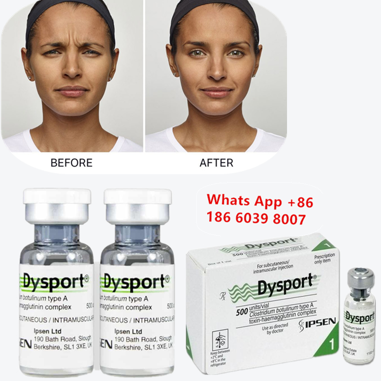 Dysport Botulinum Toxin type A voor frons en glabellijnen