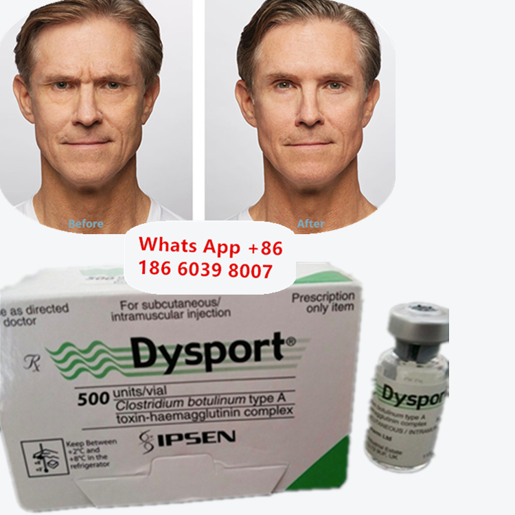 Dysport Botulinetoxine Type A Anti-Rimpel Vriesdroog Poeder