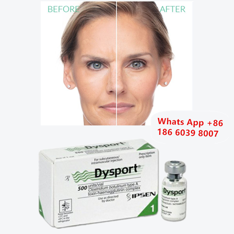 Dysport Botulinum Toxin Type A injectie voor rimpelvermindering