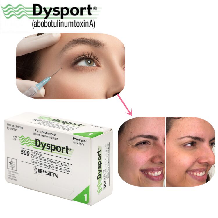 500u Dysport Gezichtsrimpel Verwijdering Vriesgedroogd Poeder Verwerking Custom OEM Dysport