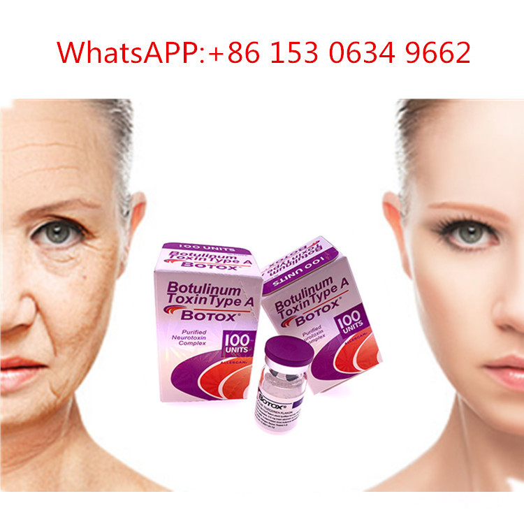 het Type van 50u 100u 150u A Allergan  Injectie Botulinum Toxine voor Antirimpel