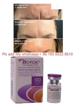 Allergan Botox Injectie Botulax Botuline Toxine Rimpels Verwijderen