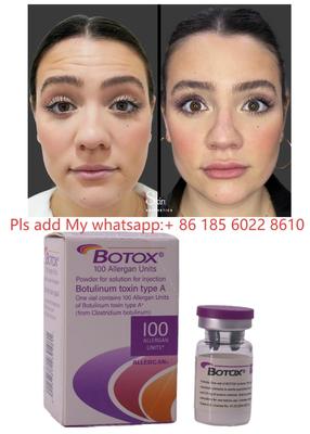 Botulax Botuline Toxine Dysport Allergan Botox voor Rimpelvermindering en Cosmetisch